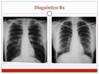 Diagnóstico Rx