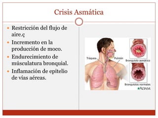 Crisis AsmáticaRestricción del flujo de aire.çIncremento en la producción de moco.Endurecimiento de músculatura bronquial.Inflamación de epitelio de vías aéreas.