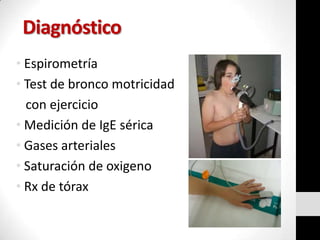 Diagnóstico
• Espirometría
• Test de bronco motricidad
con ejercicio
• Medición de IgE sérica
• Gases arteriales
• Saturación de oxigeno
• Rx de tórax

 