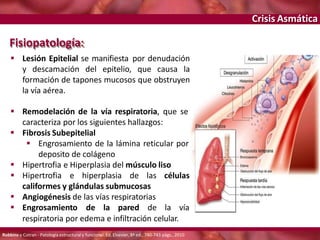 Crisis Asmática
Fisiopatología:
 Lesión Epitelial se manifiesta por denudación
y descamación del epitelio, que causa la
formación de tapones mucosos que obstruyen
la vía aérea.
 Remodelación de la vía respiratoria, que se
caracteriza por los siguientes hallazgos:
 Fibrosis Subepitelial
 Engrosamiento de la lámina reticular por
deposito de colágeno
 Hipertrofia e Hiperplasia del músculo liso
 Hipertrofia e hiperplasia de las células
califormes y glándulas submucosas
 Angiogénesis de las vías respiratorias
 Engrosamiento de la pared de la vía
respiratoria por edema e infiltración celular.
Robbins y Cotran - Patología estructural y funcional. Ed. Elsevier, 8ª ed., 740-743 págs., 2010
 