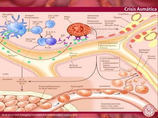 Crisis Asmática
NEJM 363;8 2010, Emergency Treatment of Asthma, Stephen C. Lazarus, M.D.
 
