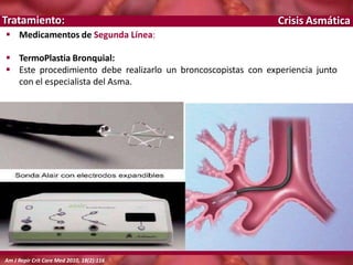 Crisis Asmática
 Medicamentos de Segunda Línea:
 TermoPlastia Bronquial:
 Este procedimiento debe realizarlo un broncoscopistas con experiencia junto
con el especialista del Asma.
Tratamiento:
Am J Repir Crit Care Med 2010, 18(2):116
 