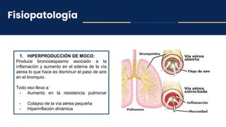 Fisiopatología
1. HIPERPRODUCCIÓN DE MOCO:
Produce broncoespasmo asociado a la
inflamación y aumento en el edema de la vía
aérea lo que hace es disminuir el paso de aire
en el bronquio.
Todo eso lleva a:
- Aumento en la resistencia pulmonar
- Colapso de la vía aérea pequeña
- Hiperinflación dinámica
 