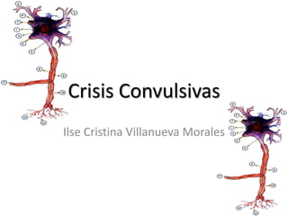 Crisis Convulsivas
Ilse Cristina Villanueva Morales
 