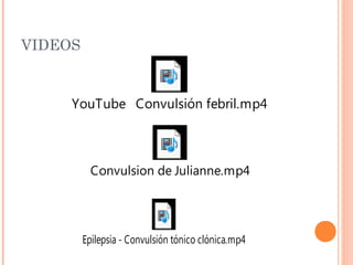 VIDEOS
YouTube Convulsión febril.mp4
Convulsion de Julianne.mp4
Epilepsia - Convulsión tónico clónica.mp4
 