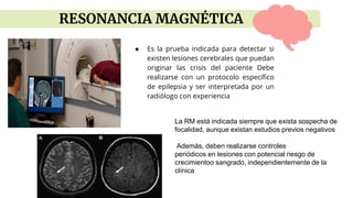 ● Es la prueba indicada para detectar si
existen lesiones cerebrales que puedan
originar las crisis del paciente Debe
realizarse con un protocolo específico
de epilepsia y ser interpretada por un
radiólogo con experiencia
RESONANCIA MAGNÉTICA
La RM está indicada siempre que exista sospecha de
focalidad, aunque existan estudios previos negativos
Además, deben realizarse controles
periódicos en lesiones con potencial riesgo de
crecimientoo sangrado, independientemente de la
clínica
 
