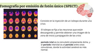 Consiste en la inyección de un isótopo durante una
crisis
El isótopo se fija a las neuronas que están
descargando y permite obtener una imagen de la
zona de inicio y propagación de las crisis
Tomografía por emisión de fotón único (SPECT)
período ictal es la convulsión propiamente dicha, y
el período interictal es el período entre crisis
convulsivas, donde la actividad cerebral es más
normal.
 