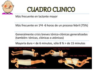 Más frecuente en lactante mayor
Más frecuente en 1ª4 -6 horas de un proceso febril (75%)
Generalmente crisis breves tónico-clónicas generalizadas
(también: tónicas, clónicas o atónicas)
Mayoría dura < de 6 minutos, sólo 8 % > de 15 minutos
 