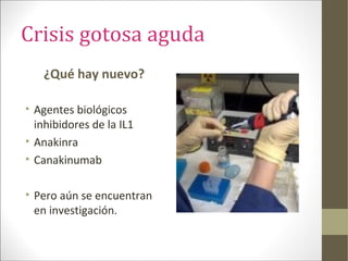 Crisis gotosa aguda
¿Qué hay nuevo?
• Agentes biológicos
inhibidores de la IL1
• Anakinra
• Canakinumab
• Pero aún se encuentran
en investigación.
 