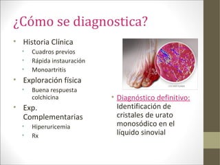 ¿Cómo se diagnostica?
• Historia Clínica
• Cuadros previos
• Rápida instauración
• Monoartritis
• Exploración física
• Buena respuesta
colchicina
• Exp.
Complementarias
• Hiperuricemia
• Rx
• Diagnóstico definitivo:
Identificación de
cristales de urato
monosódico en el
líquido sinovial
 