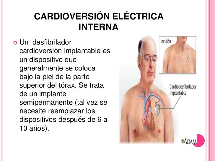 Crisis hipertensiva
