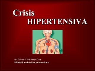 Crisis
HIPERTENSIVA
Dr. Edison D. Gutiérrez Cruz
R2 Medicina Familiar y Comunitaria
 