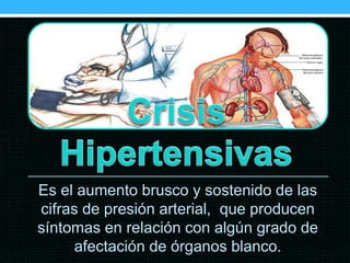 Es el aumento brusco y sostenido de las
cifras de presión arterial, que producen
síntomas en relación con algún grado de
afectación de órganos blanco.
 