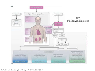 CVP
Presión venosa central
Finfer S. et. al. Circulatory Shock N Engl J Med 2013; 369:1726-34
 