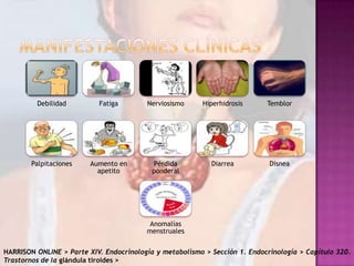 Debilidad

Fatiga

Nerviosismo

Hiperhidrosis

Temblor

Palpitaciones

Aumento en
apetito

Pérdida
ponderal

Diarrea

Disnea

Anomalías
menstruales
HARRISON ONLINE > Parte XIV. Endocrinología y metabolismo > Sección 1. Endocrinología > Capítulo 320.
Trastornos de la glándula tiroides >

 
