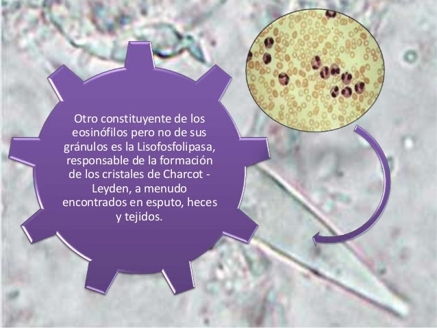 Cristales Charcot-Leyden.