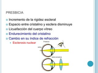 PRESBICIA

 Incremento de la rigidez escleral
 Espacio entre cristalino y esclera disminuye

 Licuefacción del cuerpo vítreo

 Endurecimiento del cristalino

 Cambio en su índice de refracción
       Esclerosis nuclear
 