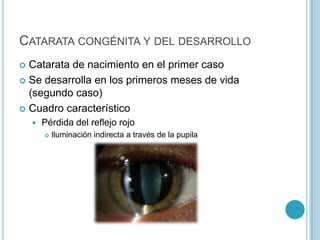 CATARATA CONGÉNITA Y DEL DESARROLLO
 Catarata de nacimiento en el primer caso
 Se desarrolla en los primeros meses de vida
  (segundo caso)
 Cuadro característico
       Pérdida del reflejo rojo
           Iluminación indirecta a través de la pupila
 