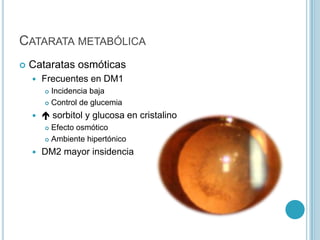 CATARATA METABÓLICA
   Cataratas osmóticas
       Frecuentes en DM1
         Incidencia baja
         Control de glucemia

        sorbitol y glucosa en cristalino
         Efecto osmótico
         Ambiente hipertónico

       DM2 mayor insidencia
 