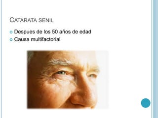 CATARATA SENIL
 Despues de los 50 años de edad
 Causa multifactorial
 