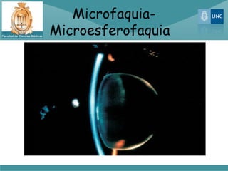 Microfaquia-
Microesferofaquia
 