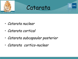 Catarata

• Catarata nuclear

• Catarata cortical

• Catarata subcapsular posterior

• Catarata cortico-nuclear
 