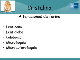 Cristalino
          Alteraciones de forma

•   Lenticono
•   Lentiglobo
•   Coloboma
•   Microfaquia
•   Microesferofaquia
 