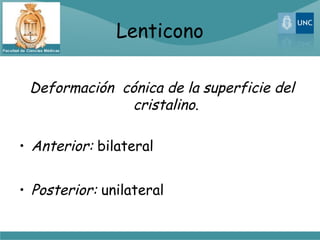 Lenticono

 Deformación cónica de la superficie del
              cristalino.

• Anterior: bilateral


• Posterior: unilateral
 