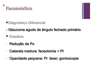+
Facomórfico
Diagnóstico Diferencial
- Glaucoma agudo de ângulo fechado primário- Glaucoma agudo de ângulo fechado primário
 Conduta
- Redução da PoRedução da Po
- Catarata madura: facectomia + PICatarata madura: facectomia + PI
- Opacidade pequena: PI laser; gonioscopiaOpacidade pequena: PI laser; gonioscopia
 