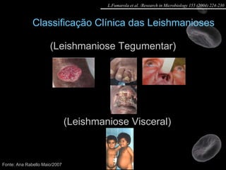 (Leishmaniose Tegumentar) Classificação Clínica das Leishmanioses (Leishmaniose Visceral) Fonte: Ana Rabello Maio/2007 L.Fumarola et al. /Research in Microbiology 155 (2004) 224-230 