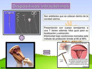 Son artefactos que se colocan dentro de la 
cavidad uterina. 
Presentación son cuerpo semejantes a 
una T tienen además hilos guía para su 
localización y extracción. 
Efectividad bajo condiciones normales este 
método de protección brinda el 95 al 99% 
 