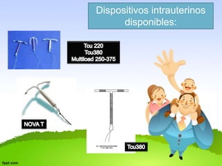 Dispositivos intrauterinos 
disponibles: 
 