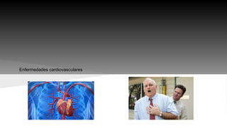 Enfermedades cardiovasculares 
 