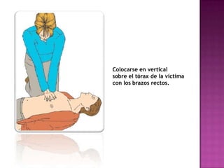 Colocarse en vertical
sobre el tórax de la víctima
con los brazos rectos.
 