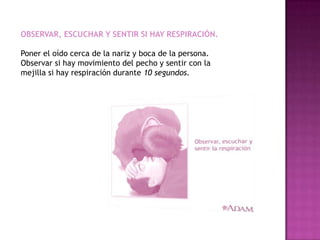 OBSERVAR, ESCUCHAR Y SENTIR SI HAY RESPIRACIÓN.

Poner el oído cerca de la nariz y boca de la persona.
Observar si hay movimiento del pecho y sentir con la
mejilla si hay respiración durante 10 segundos.
 