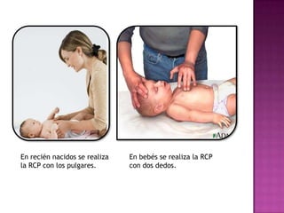 En recién nacidos se realiza   En bebés se realiza la RCP
la RCP con los pulgares.       con dos dedos.
 