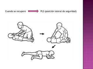 Cuando se recupere   PLS (posición lateral de seguridad)
 