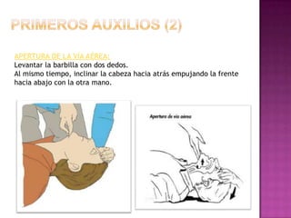 APERTURA DE LA VÍA AÉREA:
Levantar la barbilla con dos dedos.
Al mismo tiempo, inclinar la cabeza hacia atrás empujando la frente
hacia abajo con la otra mano.
 