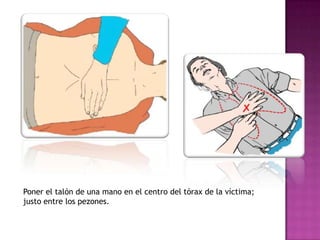 Poner el talón de una mano en el centro del tórax de la víctima;
justo entre los pezones.
 