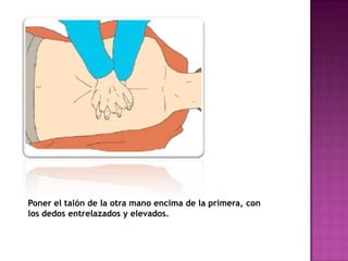 Poner el talón de la otra mano encima de la primera, con
los dedos entrelazados y elevados.
 