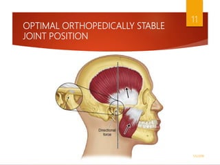 OPTIMAL ORTHOPEDICALLY STABLE
JOINT POSITION
1/5/2018
11
 