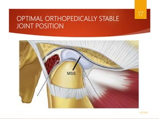 OPTIMAL ORTHOPEDICALLY STABLE
JOINT POSITION
1/5/2018
17
 