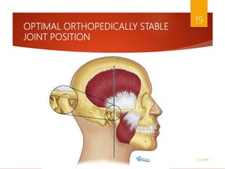 OPTIMAL ORTHOPEDICALLY STABLE
JOINT POSITION
1/5/2018
19
 