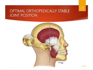 OPTIMAL ORTHOPEDICALLY STABLE
JOINT POSITION
1/5/2018
21
 