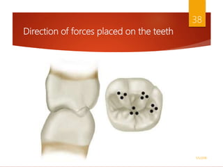 Direction of forces placed on the teeth
1/5/2018
38
 