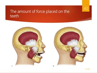 The amount of force placed on the
teeth
1/5/2018
40
 