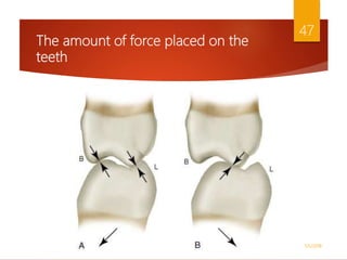 The amount of force placed on the
teeth
1/5/2018
47
 