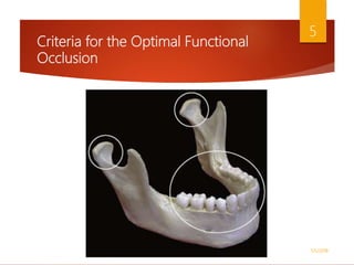 Criteria for the Optimal Functional
Occlusion
1/5/2018
5
 