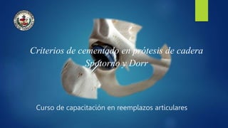 Criterios de cementado en prótesis de cadera
Spotorno y Dorr
 