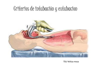 Criterios de intubación y extubacion
TSU Yelitza meza
 